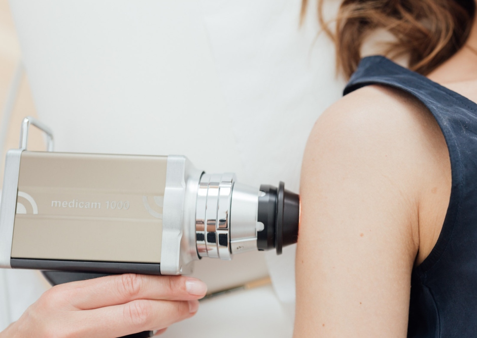 w hautkrebsvorsorge 1