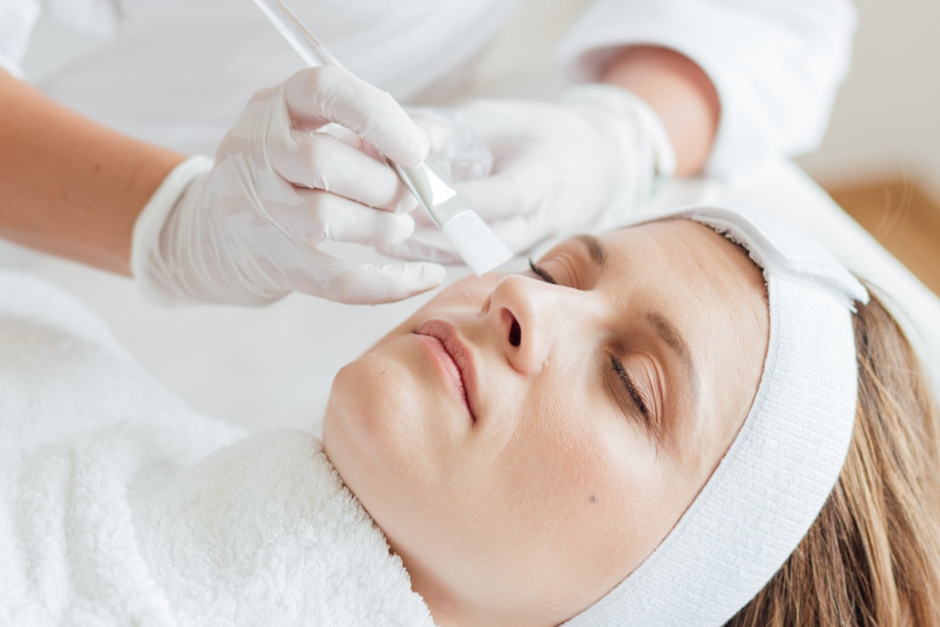 W chemische peelimgs 2 W chemische peelimgs 2