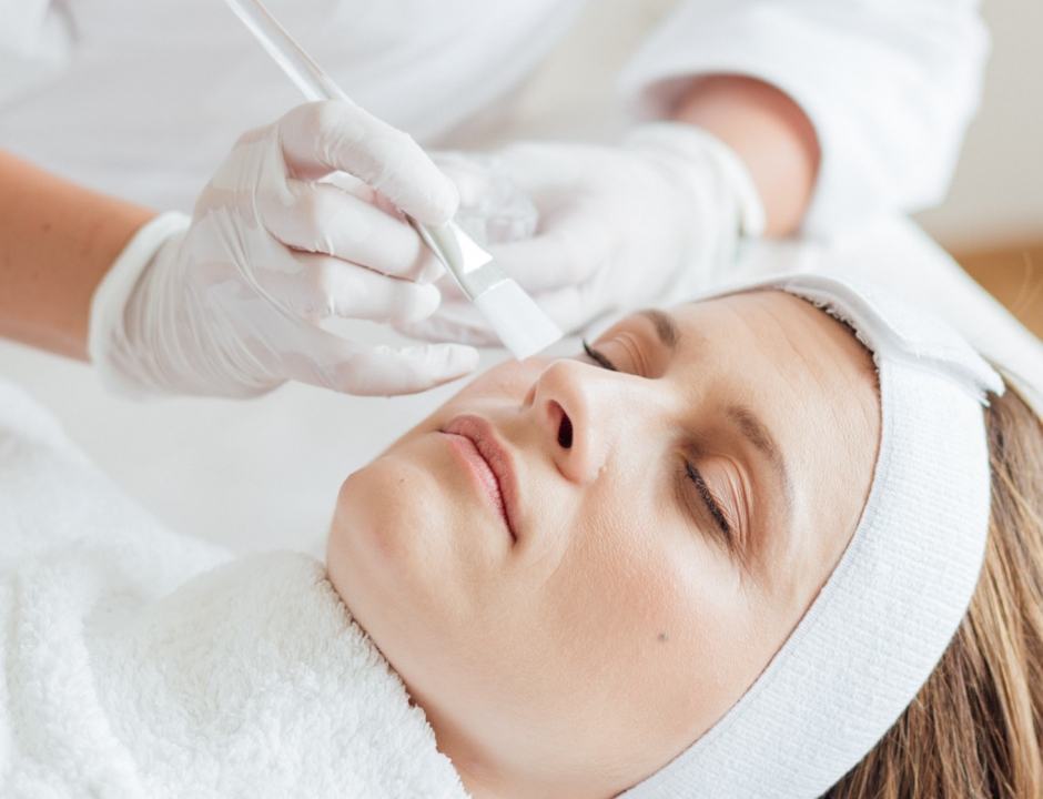 W chemische peelimgs 2 W chemische peelimgs 2