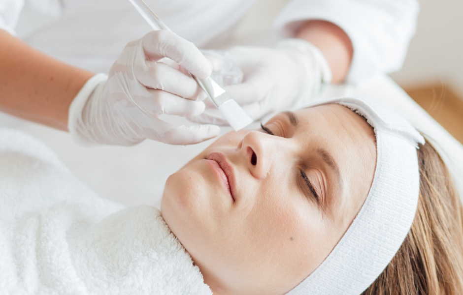 W chemische peelimgs 2 W chemische peelimgs 2