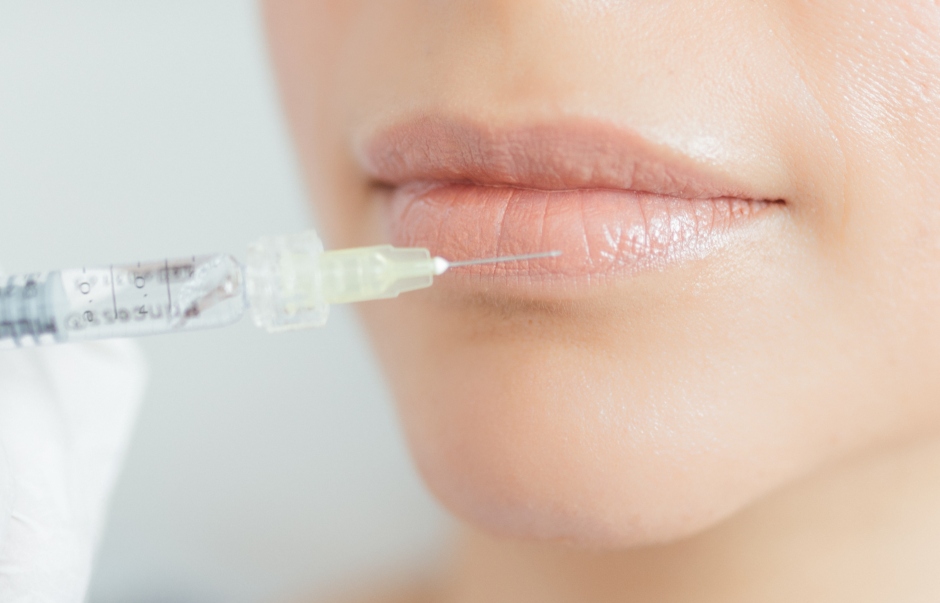 W Hyaluron Lippenunterspritzung 1 W Hyaluron Lippenunterspritzung 1