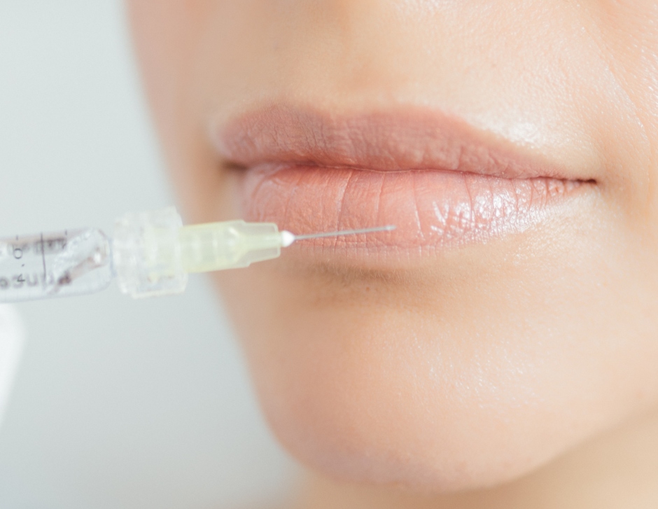 W Hyaluron Lippenunterspritzung 1 W Hyaluron Lippenunterspritzung 1