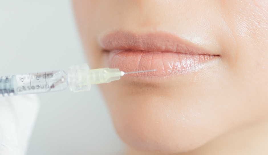 W Hyaluron Lippenunterspritzung 1 W Hyaluron Lippenunterspritzung 1